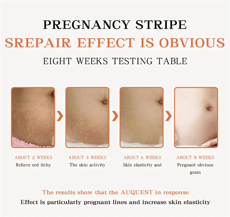 Maternity Scar Stretch Marks Cream