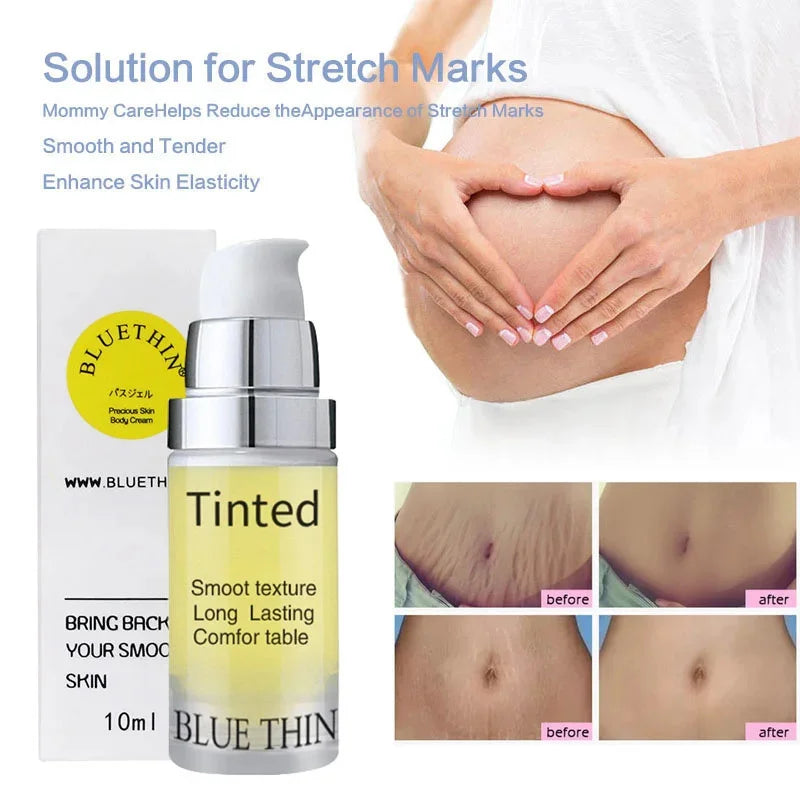 Maternity Scar Stretch Marks Cream