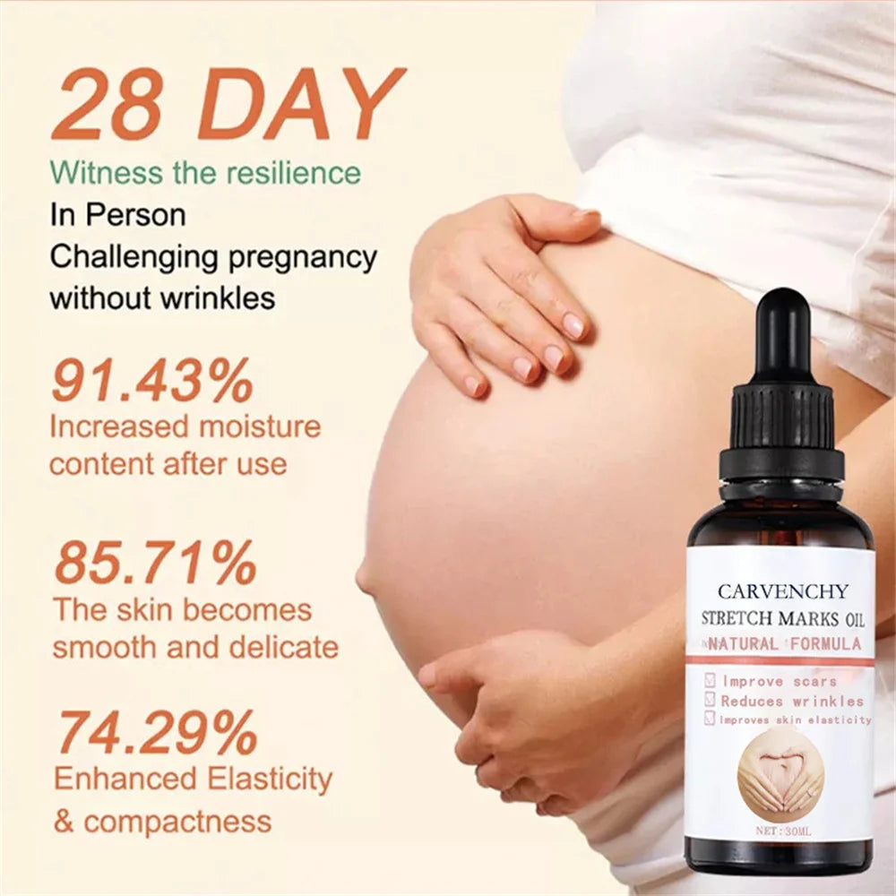 Stretch Marks Remover Oil