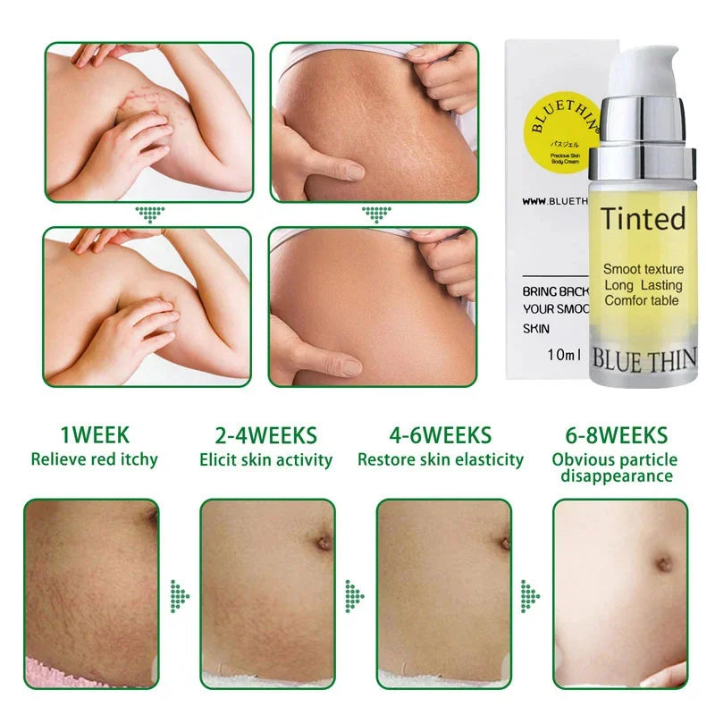 Maternity Scar Stretch Marks Cream