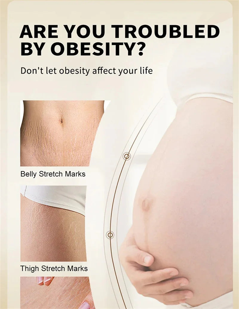 Maternity Scar Stretch Marks Cream