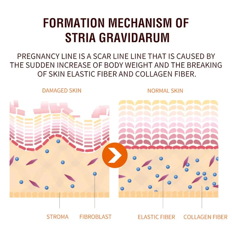 Maternity Scar Stretch Marks Cream