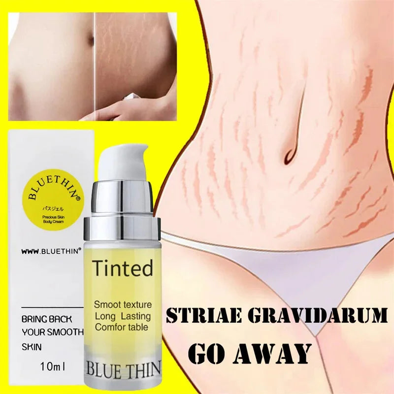 Maternity Scar Stretch Marks Cream
