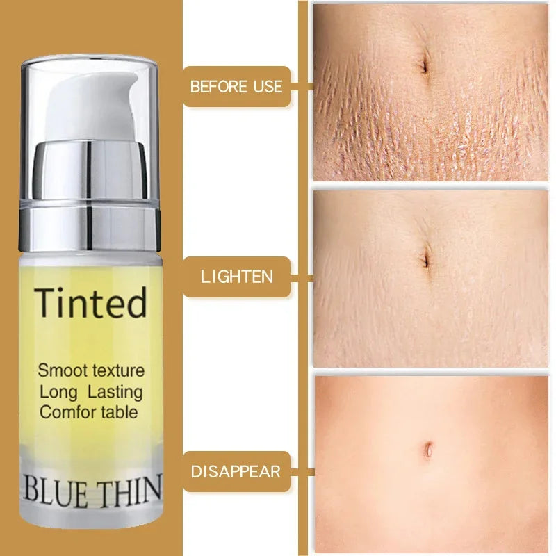 Maternity Scar Stretch Marks Cream