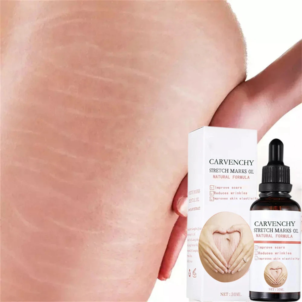 Stretch Marks Remover Oil