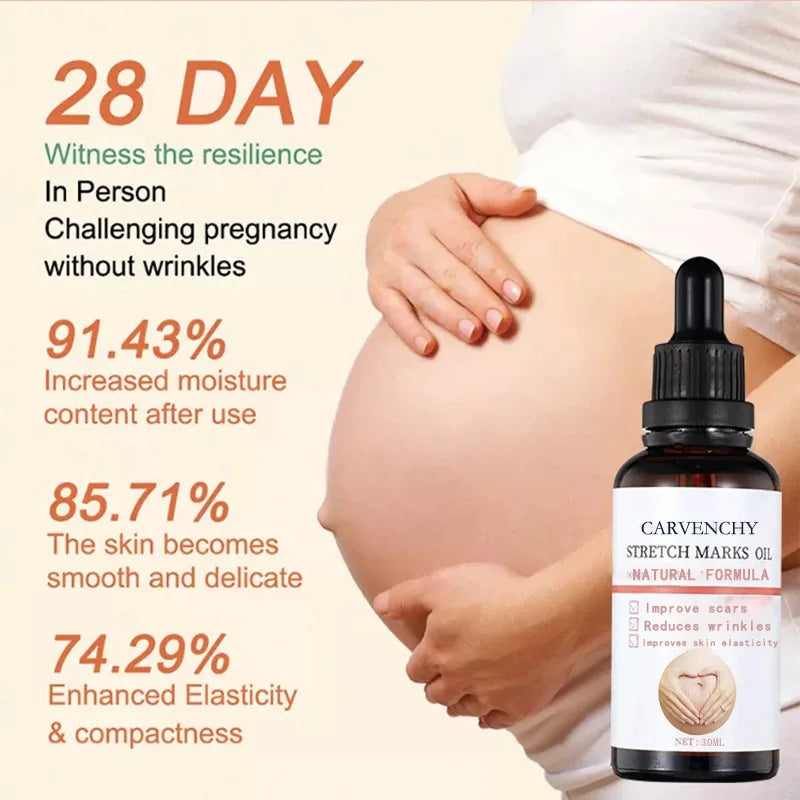 Stretch Marks Remover Oil