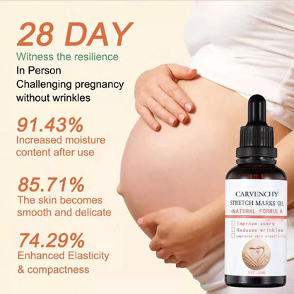 Stretch Marks Remover Oil