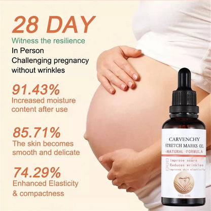 Stretch Marks Remover Oil