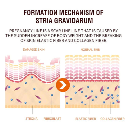 Maternity Scar Stretch Marks Cream
