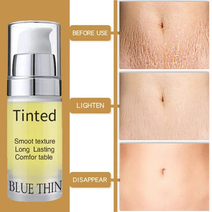 Maternity Scar Stretch Marks Cream